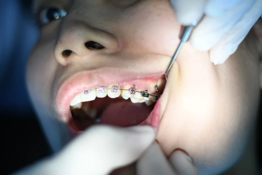 Tooth.