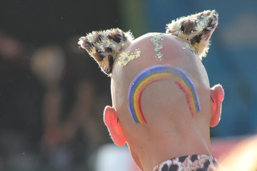 Baldness