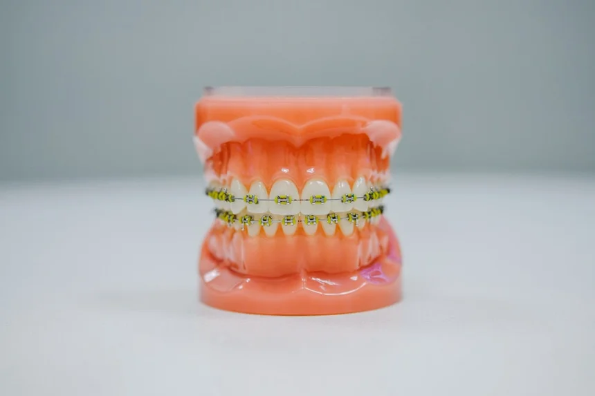 Braces