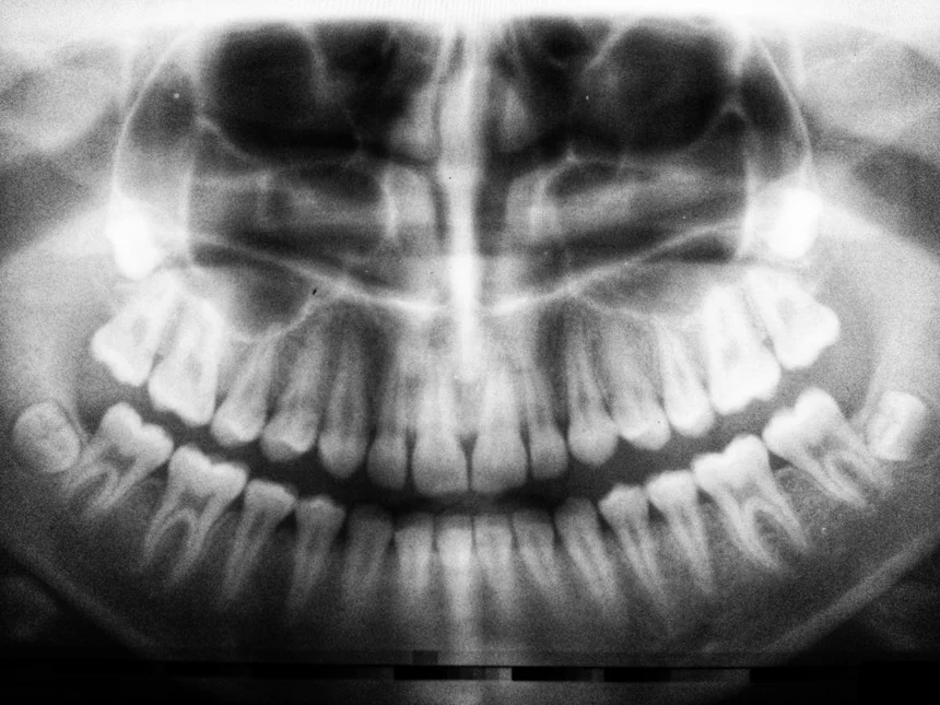 Teeth