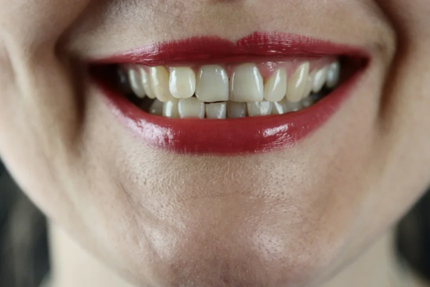 Teeth
