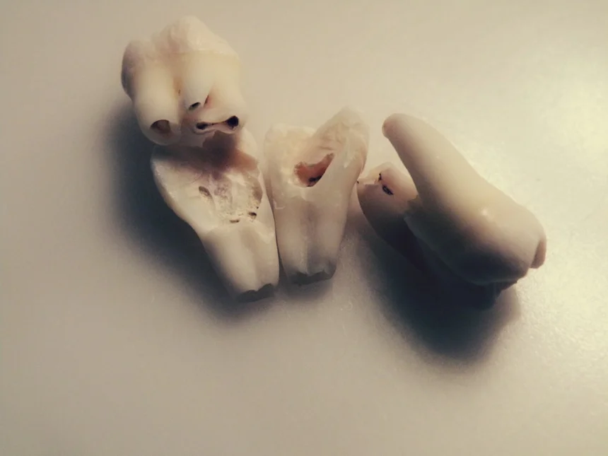 Tooth.