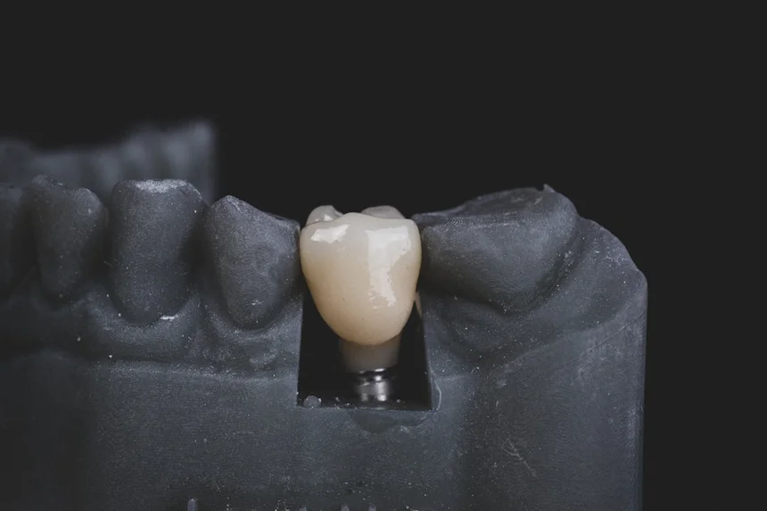 Tooth